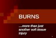 1 BURNS …more than just another soft tissue injury