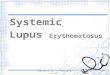 Systemic Lupus Erythematosus 1 Presented by: J. Yeban & A. Arante
