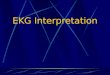 EKG Interpretation. EKG Interpretation Sequence Regular or Irregular Rate P wave PR interval (normal 0.12-0.20) QRS (less than 0.12) ST segment T wave