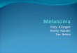 Cory Klinger Korey Kainec Ian Behra. What is Melanoma?? Melanoma is a malignant tumor. If not found early, melanoma can ne very dangerous. It is responsible