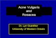 Acne Vulgaris and Rosacea Dr. Lyn Guenther University of Western Ontario