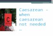 Caesarean – when caesarean not needed …. Definition-CS rate  CS rate is defined as the number of caesarean deliveries over the total number of live births,