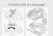 Frontal Lobe & Language. Phineas Gage Phineas Gage was foreman of a dynamite crew working for the Rutland and Burlington Railroad in New England when