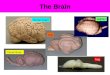 The Brain Human brain Camel Brain Cat dolphin frog