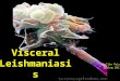Visceral Leishmaniasis Collin Price Spring 2011. Visceral Leishmaniasis – also known as Kala Azar – is a systemic disease that primarily affects the liver,