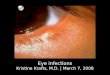 Eye infections Kristine Krafts, M.D. | March 7, 2008