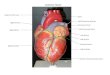 Aorta Left Pulmonary Arteries Left Atrium Coronary Sulcus Left Ventricle Anterior Interventricular Sulcus Right Ventricle Superior Vena Cava Right Atrium