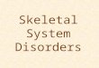 Skeletal System Disorders. Osteomyelitis Infection of the bone Causes include: invading bacteria, pneumonia, typhoid, inflammation of teeth, and injury