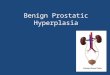 Benign Prostatic Hyperplasia. Objectives Upon Completion of this CME activity, the learner will be able to: – Understanding the current medical management