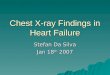 Chest X-ray Findings in Heart Failure Stefan Da Silva Jan 18 th 2007