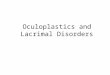 Oculoplastics and Lacrimal Disorders. Epiphora Blepharitis Nasolacrimal duct occlusion Eyelid malposition Ectropion Entropion Eyelid tumours Basal cell