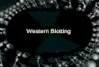 Western Blotting. Western blotting/Immunoblotting Technique for detecting specific proteins separated by electrophoresis by use of labeled antibodies