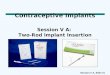 Session V A, Slide #1 Contraceptive Implants Session V A: Two-Rod Implant Insertion