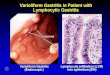 Varioliform Gastritis In Patient With Lymphocytic Gastritis
