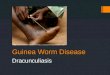 Guinea Worm Disease Dracunculiasis http:// sph.bu.edu/otlt/MPH-Modules/PH/PH709_B_Competition/PH709_B_Competition7.html