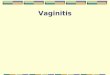 Vaginitis. Signs and symptoms Symptoms may include: Change in color, odor or amount of discharge from your vagina Vaginal itching or irritation Pain