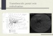 Transileocolic portal vein embolisation. Embolisation of Right Hepatic Artery Arteriography of Right Hepatic Artery Spiral embolisation of Right Hepatic