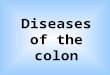 Diseases of the colon. Epidemiology Colon cancer is one of the first places in the structure of cancer. Among the malignant tumors of the digestive cancer