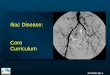 ICVWG 09-1 Iliac Disease: Core Curriculum. ICVWG 09-2 Iliac Disease Diagnosis Indications Technical Issues Treatment Options - PTA - Surgical Complications