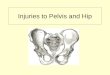 Injuries to Pelvis and Hip. Anatomy of Pelvis Bones of pelvic girdle 1. ilium 2. ischium 3. pubis 4. sacrum ** ilium, ischium, and pubis combined form