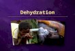 Dehydration. 70% water 70% water What can cause dehydration? Neglecting to drink water Much sweating Diarrhoea or vomiting Too sick to eat or drink