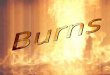 Types of Burns Thermal Chemical Electrical Energy (laser, welding, etc
