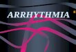ARRHYTHMIA. Disturbance of cardiac rythumn Anatomy of the conducting system