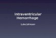 Intraventricular Hemorrhage Luke Johnson. Overview IVH Most common brain implication in premature babies Bleeding into the ventricles Underdeveloped