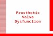Prosthetic Valve Dysfunction. Usually this information is in the patient’s chart. Identification cards are usually issued to a patent indicating the type