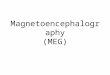 Magnetoencephalography (MEG)