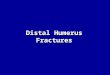 Distal  Humerus  Fractures