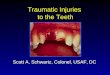 Traumatic Injuries  to the Teeth