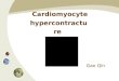 Cardiomyocyte hypercontracture