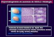 Espermatogenesis en ausencia de SGOL2: Histología
