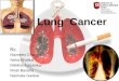 Lung  Cancer