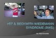 p 57 & Beckwith- Wiedemann  syndrome (BWS)