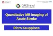 Quantitative MR Imaging of Acute Stroke