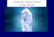 Congestive Heart Failure A Real Threat