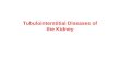 Tubulointerstitial Diseases of the Kidney
