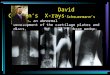 David Cashman’s  X-rays