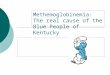 Methemoglobinemia: The real cause of the Blue People of Kentucky