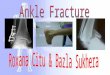 Ankle Fracture