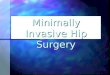 Minimally Invasive Hip Surgery