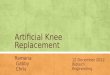 Artificial Knee Replacement