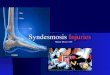Syndesmosis  Injuries
