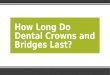 How Long Do Dental Crowns and Bridges Last?