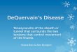 DeQuervain’s Disease