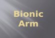 Bionic Arm