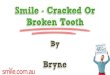 ppt 10944 Smile Cracked Or Broken Tooth