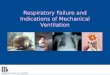 Respiratory Failure and Indications of Mechanical Ventilation